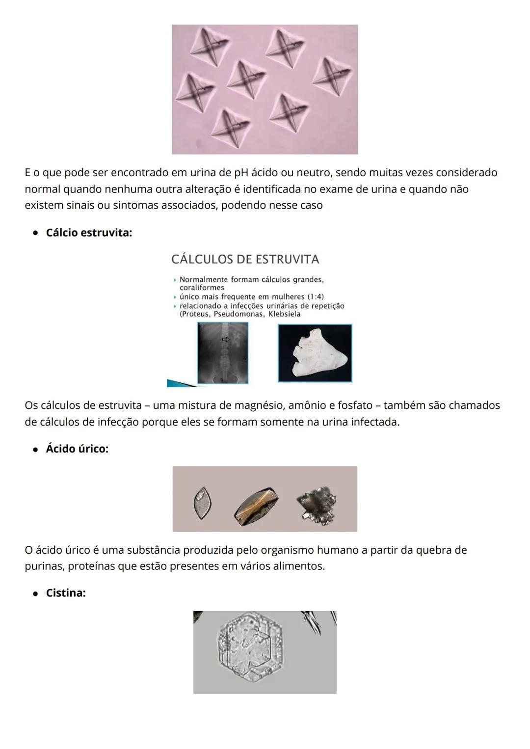# Resumo de
urinalíse
Eleticiana Lima de Farias Catunda.
Introdução
O exame EAS costuma ser solicitado para auxiliar o médico a identific