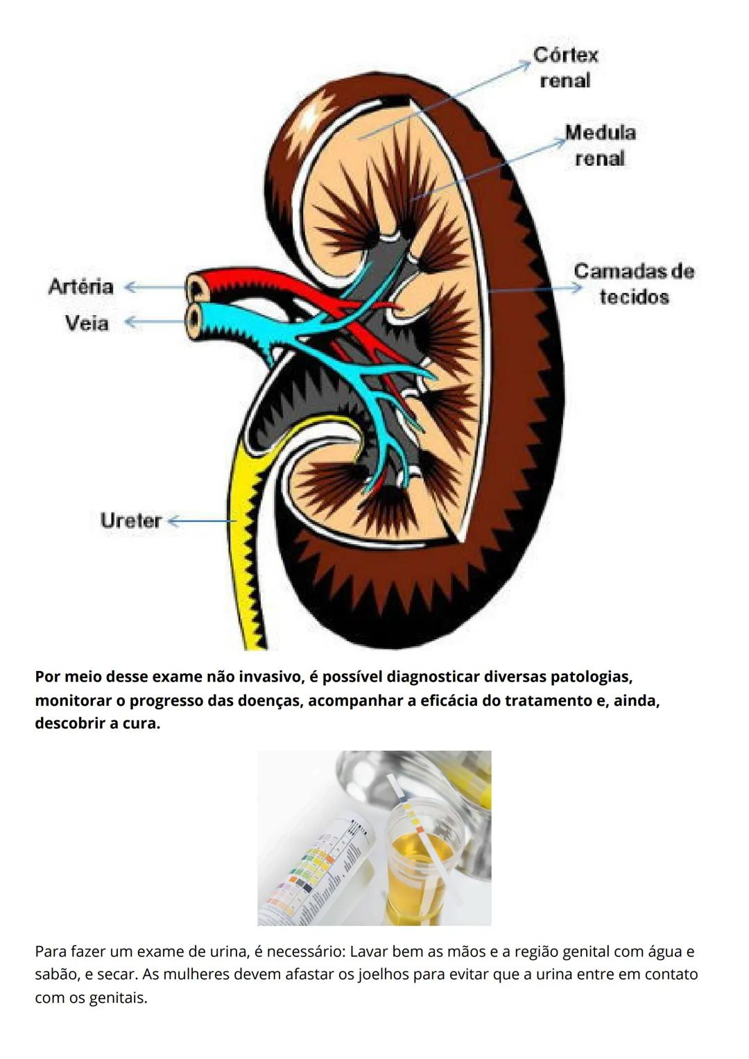 # Resumo de
urinalíse
Eleticiana Lima de Farias Catunda.
Introdução
O exame EAS costuma ser solicitado para auxiliar o médico a identific