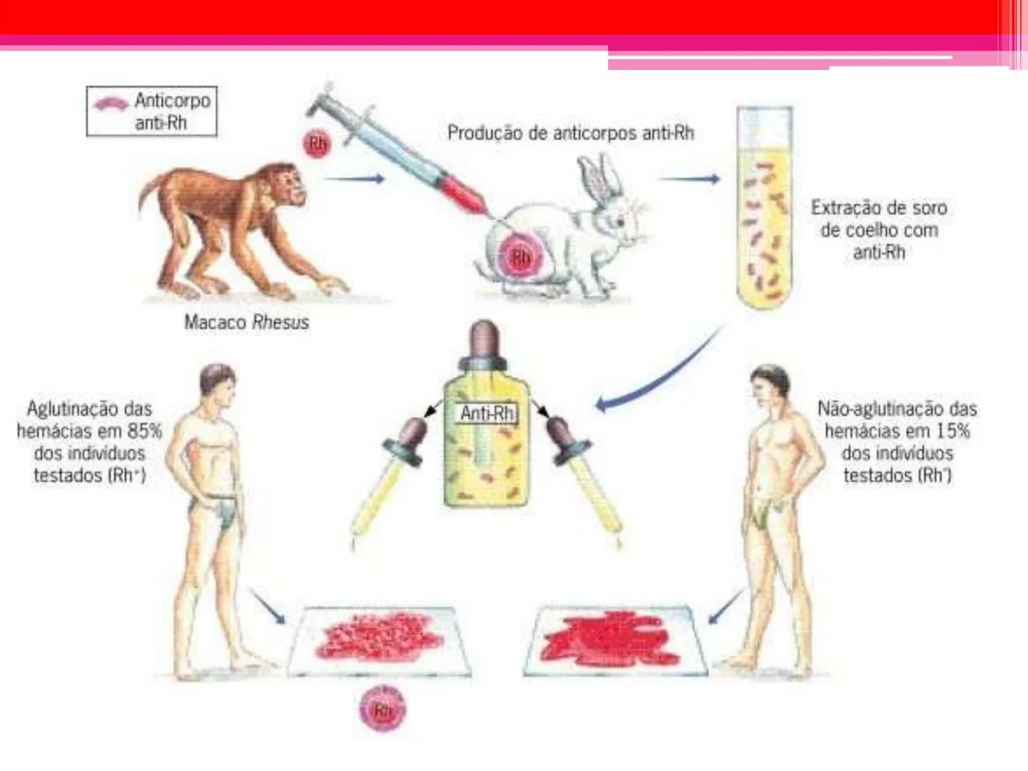 # Tipos sanguíneos e Eritroblastose
Fetal # Sistema ABO - alelos múltiples # A descoberta dos grupos sanguíneos
- Estudado em 1900pelo médi