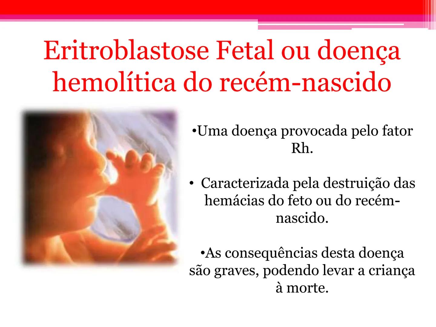 # Tipos sanguíneos e Eritroblastose
Fetal # Sistema ABO - alelos múltiples # A descoberta dos grupos sanguíneos
- Estudado em 1900pelo médi