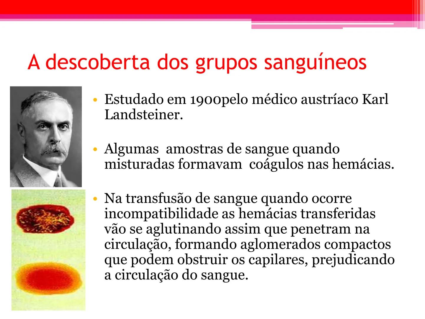 # Tipos sanguíneos e Eritroblastose
Fetal # Sistema ABO - alelos múltiples # A descoberta dos grupos sanguíneos
- Estudado em 1900pelo médi