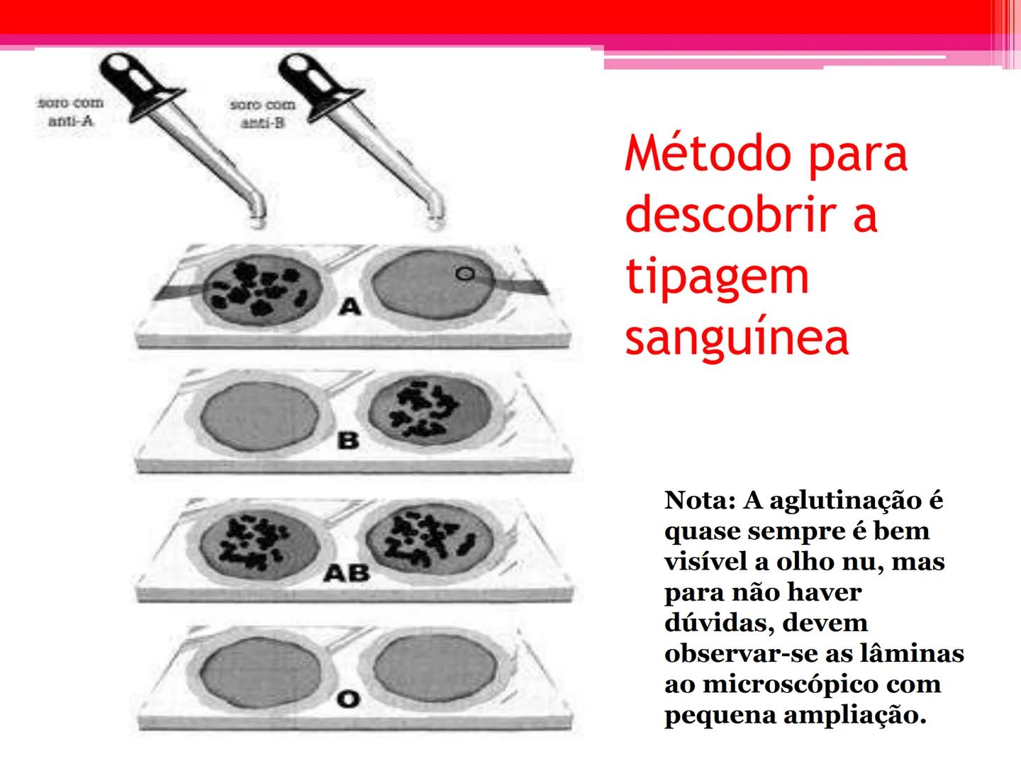 # Tipos sanguíneos e Eritroblastose
Fetal # Sistema ABO - alelos múltiples # A descoberta dos grupos sanguíneos
- Estudado em 1900pelo médi