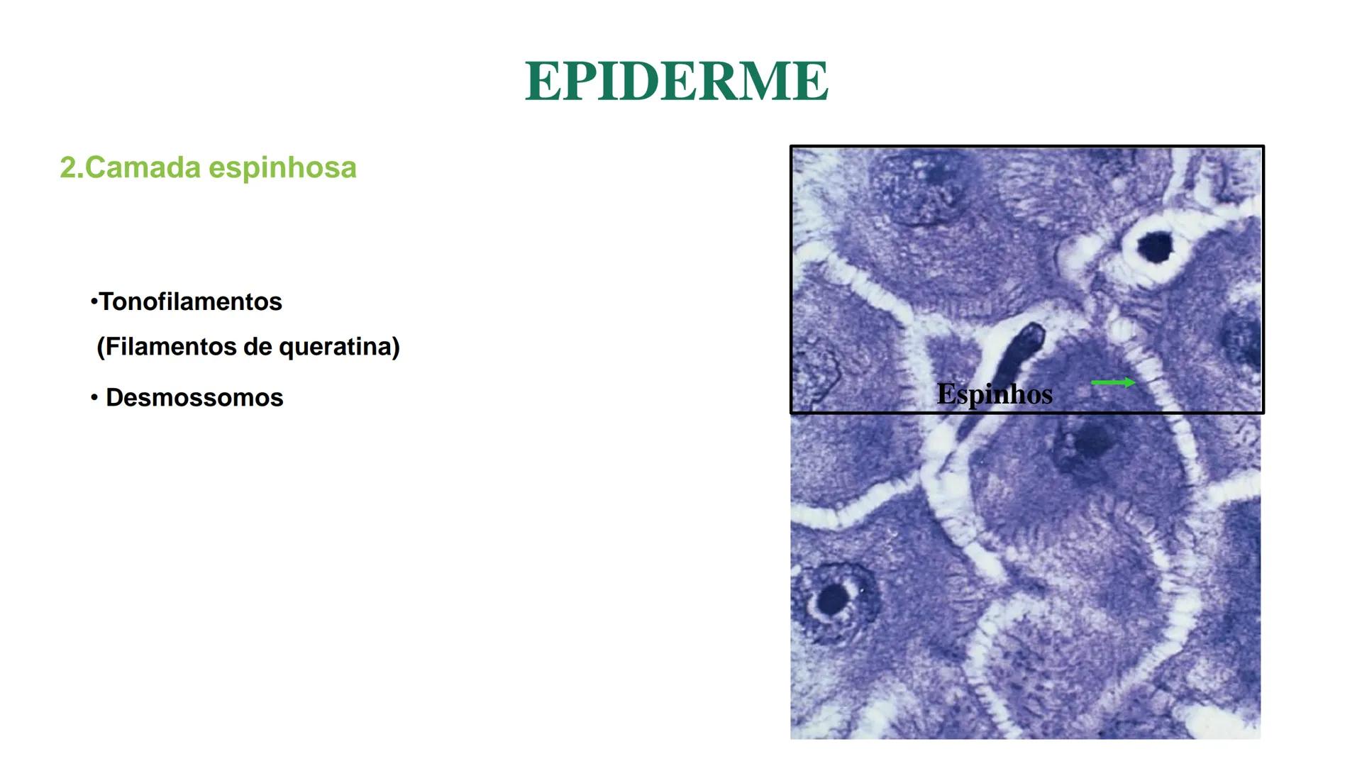 Subcutaneous fat
Arrector pili muscle
Hair follicle
crine swe
laceous
id
cine
weat duc
SISTEMA TEGUMENTAR
ANATOMIA E FISIOLOGIA DA PELE
PROF