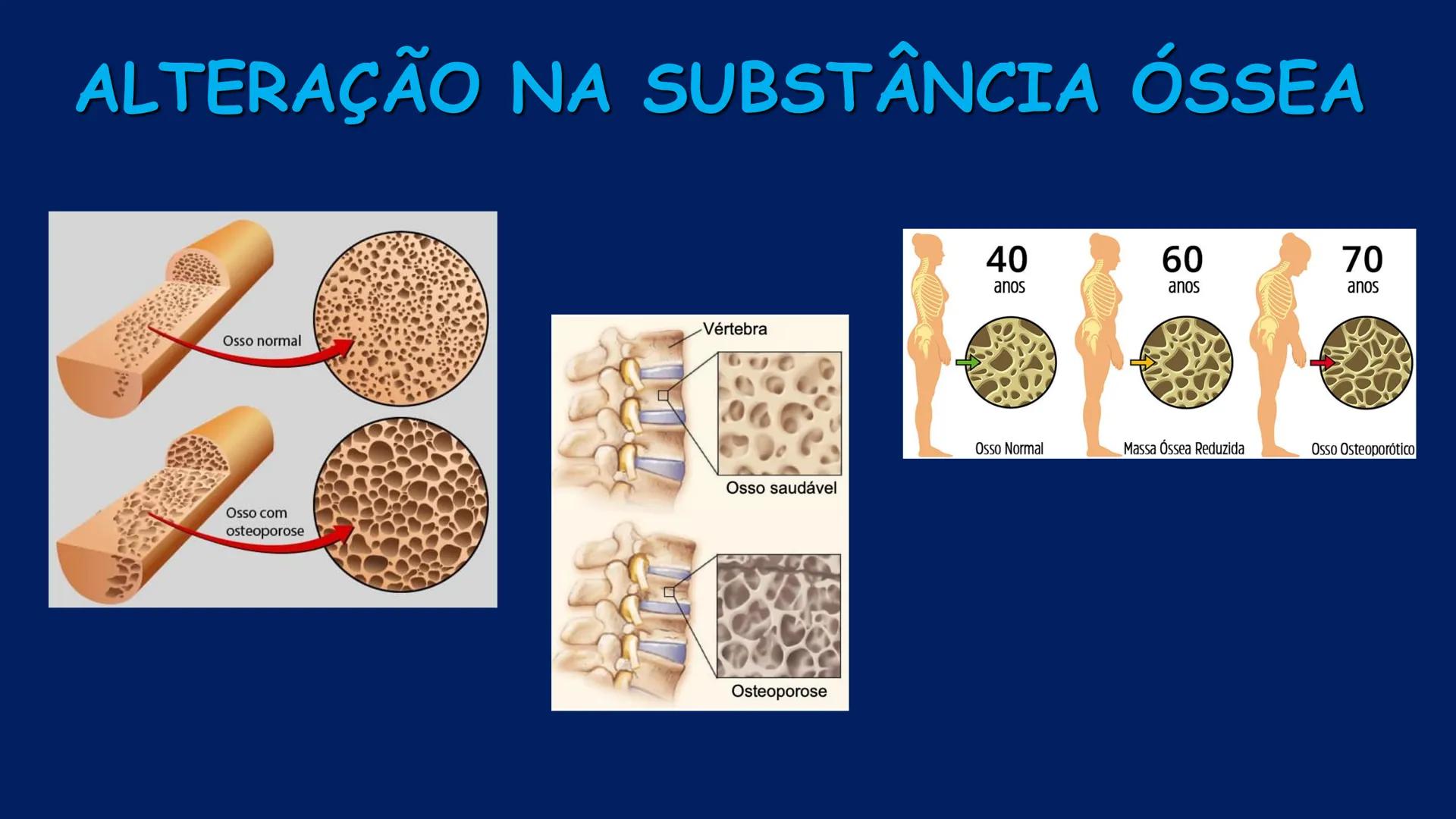# ESTRUTURA MACROSCÓPICA
DO CORPO HUMANO
Prof. Valdemir Rodrigues Pereira ## Aparelho Locomotor # APARELHO LOCOMOTOR
- Sistema Esquelétic