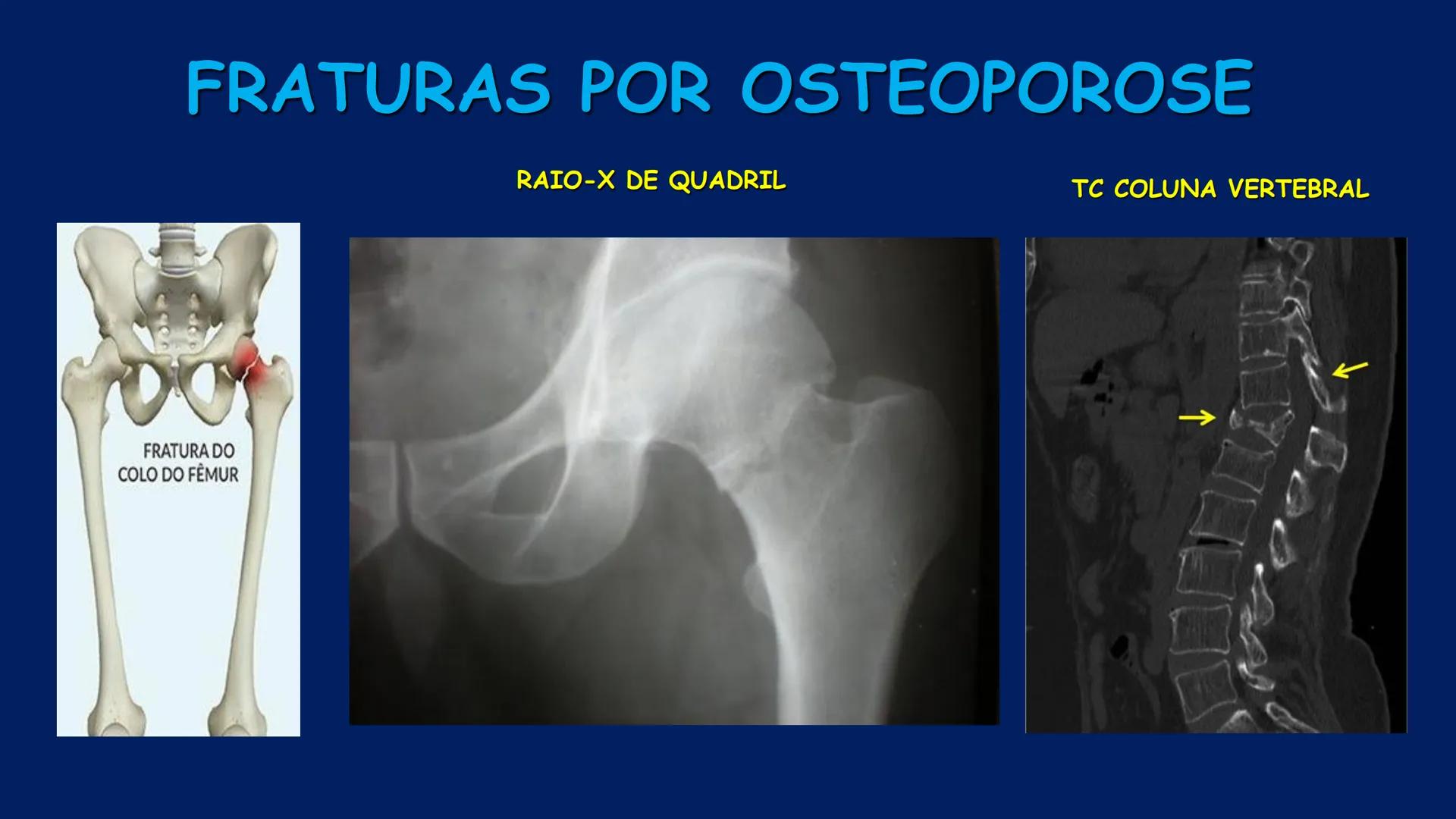 # ESTRUTURA MACROSCÓPICA
DO CORPO HUMANO
Prof. Valdemir Rodrigues Pereira ## Aparelho Locomotor # APARELHO LOCOMOTOR
- Sistema Esquelétic